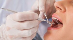 cuidados dentales